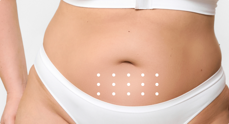 Patrón de aplicación – Abdomen